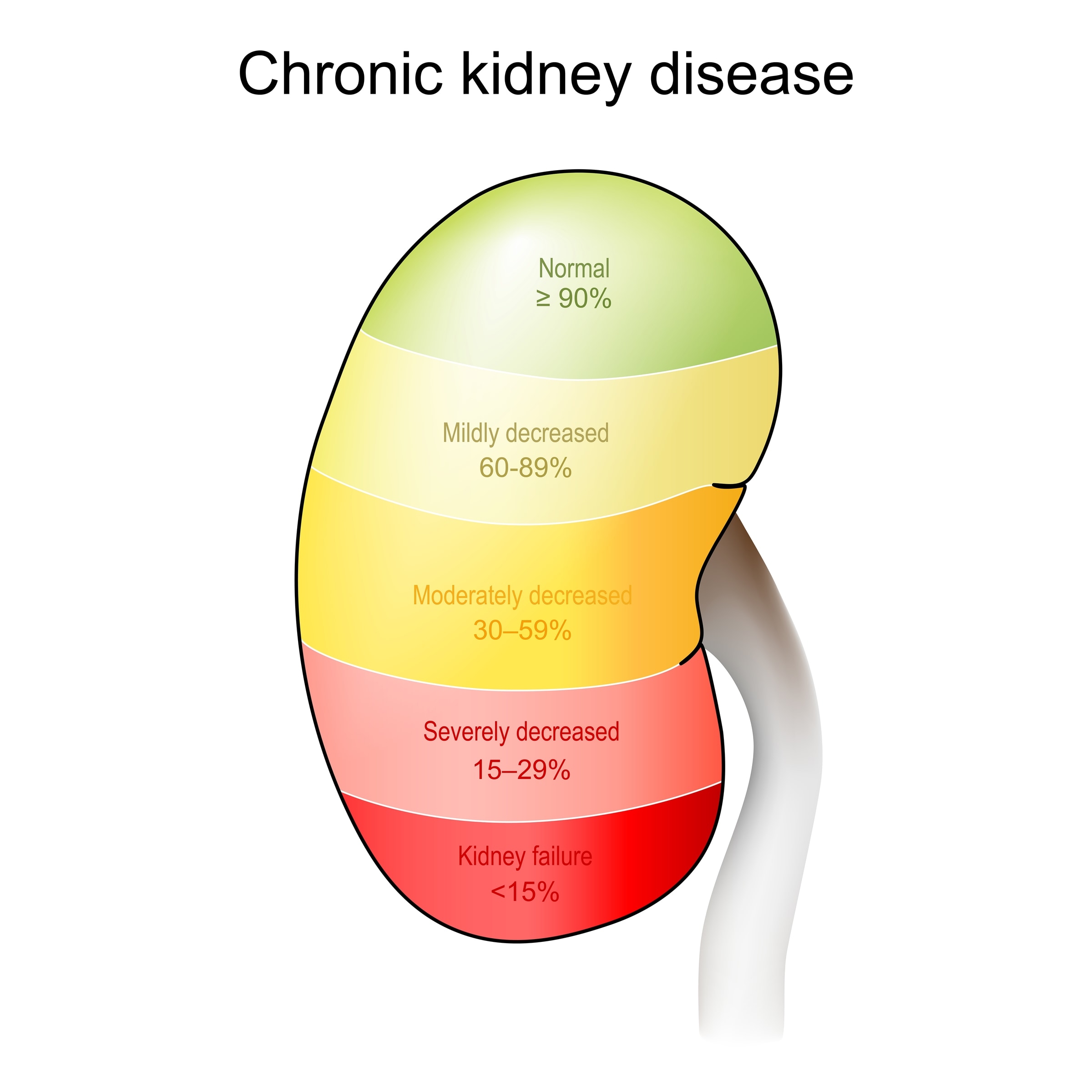 A kidney banded into the five stages of chronic kidney disease by eGFR, from normal at 90% or above down to kidney failure below 15%