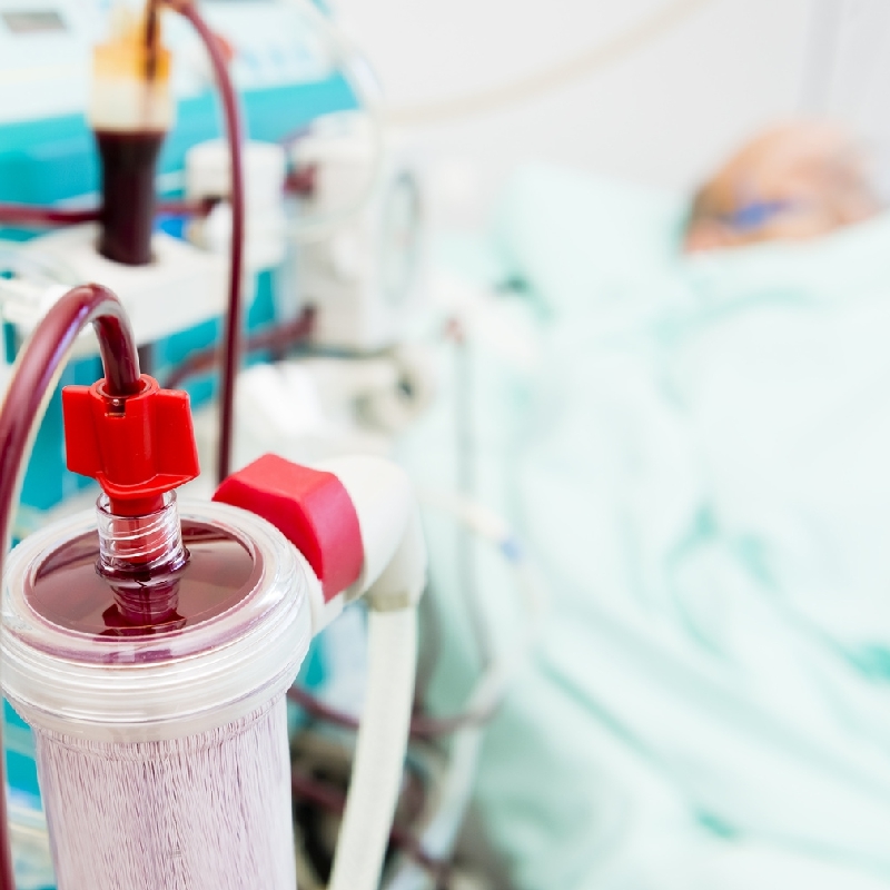 Dialysis Simplified session